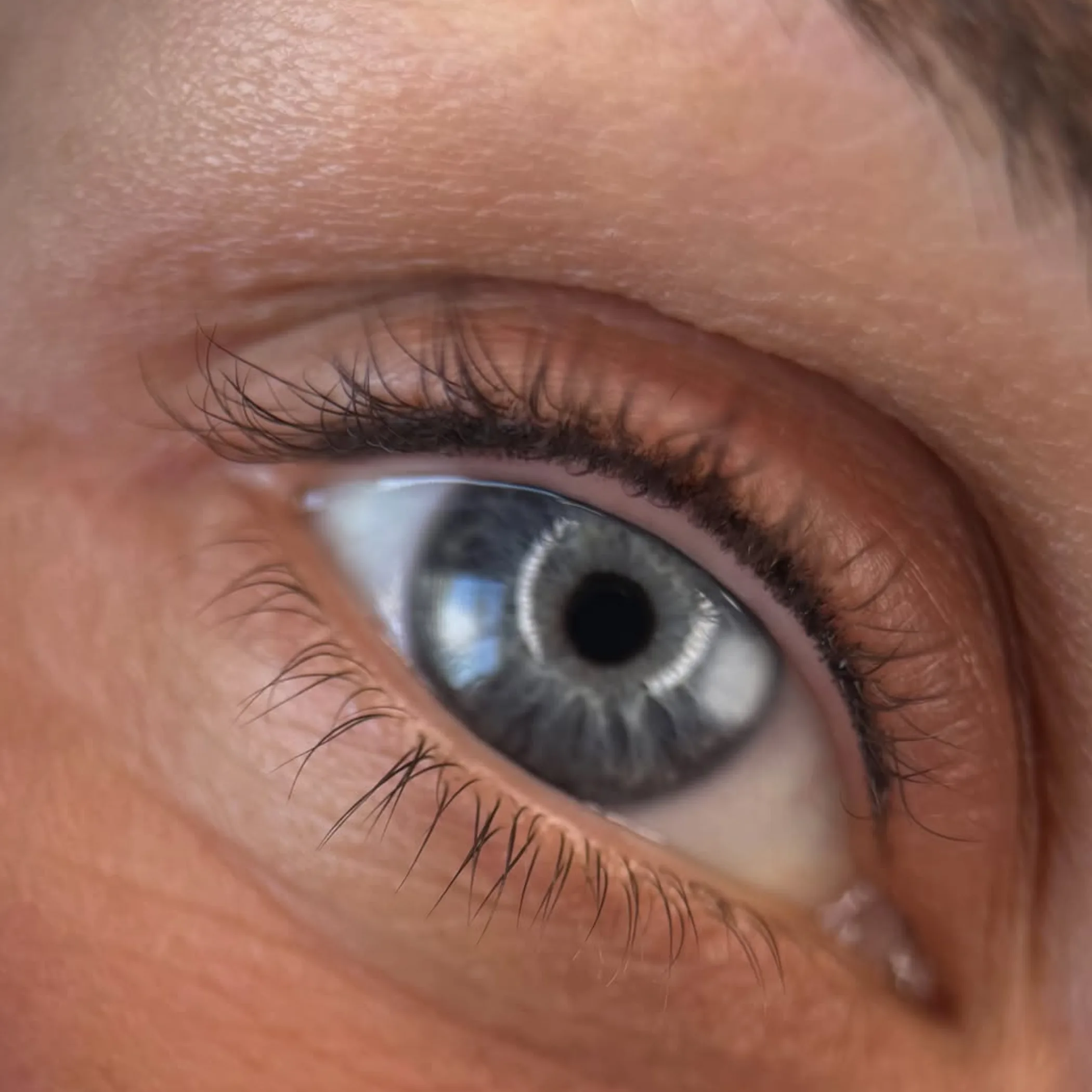 defined upper and lower lash lines